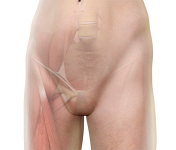Hip Groin Disorders
