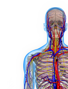 Thoracic Outlet Syndrome